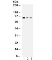 Western blot testing of human 1) MCF7, 2) COLO-320 and 3) PANC-1 lysate with ATXN1 antibody. Commonly observed molecular weight: 87-105 kDa.