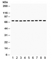 Western blot testing of 1) rat liver, 2) rat thymus, 3) rat testis, 4) mouse liver, 5) mouse kidney, 6) human HeLa, 7) human MCF7 and 8) human A375 and 9) mouse NIH3T3 lysate with HSPA2 antibody. Expected/observed molecular weight ~70 kDa.
