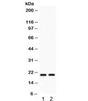 Western blot testing of 1) rat heart and 2) rat muscle lysate with HSPB2 antibody. Predicted/observed molecular weight ~20 kDa.