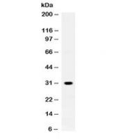 Western blot testing of rat skeletal muscle lysate with ZWINT antibody at 0.5ug/ml. Expected molecular weight ~31 kDa.