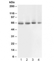 Western blot testing of 1) rat muscle, 2) human COLO320, 3) human 22RV1 and 4) human PANC lysate with ABCB10 antibody at 0.5ug/ml. Expected molecular weight: ~79 kDa (full), ~65 kDa (cleaved mitochondrial targeting sequence (amino acids 1-105)).