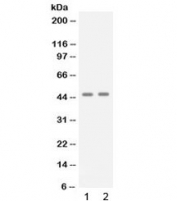 Western blot testing of 1) human A431 and 2) human Jurkat cell lysate with APOBEC3G antibody at 0.5ug/ml. Predicted molecular weight: ~46 kDa.