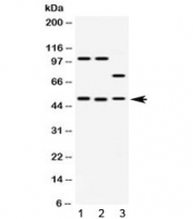 Western blot testing of 1) rat brain, 2) mouse brain and 3) human HeLa lysate with AZIN2 antibody at 0.5ug/ml. Predicted molecular weight: 22-52 kDa (multiple isoforms).