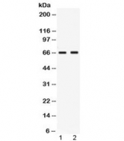 Western blot testing of human 1) MCF7 and 2) MM453 lysate with Nectin-4 antibody at 0.5ug/ml. Expected molecular weight ~55 kDa (unmodified), ~66 kDa (glycosylated).