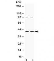 Western blot testing of human 1) HeLa and 2) U-2 OS cell lysate with RPSA antibody at 0.5ug/ml. Routinely observed molecular weight: 37-40 kDa and 67 kDa.