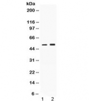 Western blot testing of 1) rat brain and 2) human HeLa lysate with AAT antibody at 0.5ug/ml. Expected molecular weight: ~47 kDa (unmodified), 52 kDa (glycosylated).