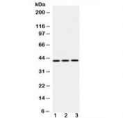 Western blot testing of 1) rat liver, 2) mouse NIH3T3 and 3) human HepG2 lysate with EBP1 antibody at 0.5ug/ml. Observed molecular weight 42 kDa (p42 isoform) and 48 kDa (p48 isoform).