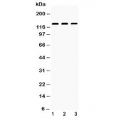 Western blot testing of 1) rat kidney, 2) mouse kidney and 3) human 293T lysate with Nephrin antibody at 0.5ug/ml. Expected molecular weight: 134 kDa (unmodified), 150-180 kDa (modified).
