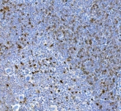 IHC testing of FFPE mouse spleen tissue with CD90 antibody. Required HIER: steam section in pH8 EDTA for 20 min and allow to cool prior to testing.