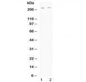 Western blot testing of human 1) HeLa and 2) A549 cell lysate with ABCC1 antibody at 0.5ug/ml. Predicted molecular weight: 152-172 kDa (multiple isoforms), can be observed at ~190 kDa, observed here at ~220 kDa.