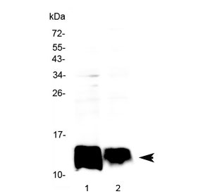 Western blot testing of human 1) HepG2 and 2) 22RV1 cell lysate with Beta-2 Microglobulin antibody at 0.5ug/ml. Predicted molecular weight ~14 kDa.
