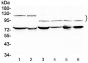 Western blot testing of 1) rat testis, 2) mouse testis, 3) human HeLa, 4) human A549 and 6) human SK-OV-3 lysate with NFATC4 antibody at 0.5ug/ml. Predicted molecular weight ~95 kDa, also can be observed at 120-140 kDa.