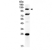 Western blot testing of human 22RV1 cell lysate with NFAT4 antibody at 0.5ug/ml. Predicted molecular weight: ~116 kDa but can be observed at 140~150 kDa due to phosphorylation.