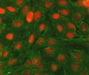 Immunofluorescent staining of FFPE human U-2 OS cells with Bcl-2 antibody (red) and Alpha Tubulin antibody (green). HIER: steam section in pH6 citrate buffer for 20 min.