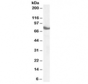 Western blot testing of mouse brain lysate with ZDHHC17 antibody at 1ug/ml. Predicted molecular weight: ~73 kDa.
