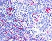 IHC testing of FFPE human tonsil with NET1 antibody at 2.5ug/ml. HIER: steamed with pH6 citrate buffer, AP-staining.
