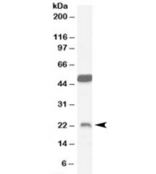 Western blot testing of mouse brain lysate with Neurturin antibody at 0.1ug/ml. The expected ~23kDa band and the additional ~50kDa band are both blocked by the immunizing peptide.