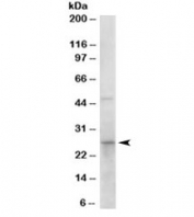 Western blot testing of human duodenum lysate with 15-PGDH antibody at 0.1ug/ml. Predicted molecular weight: ~29 kDa.