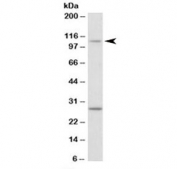 Western blot testing of NIH3T3 lysate with Myo1H antibody at 0.1ug/ml. The expected ~110 kDa band and the additional ~28 kDa band are both blocked by the immunizing peptide.