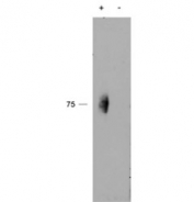 Western blot testing of immunoprecipitate from a lysate of human natural killer cells with (+) or without (-) pervanadate treatment of the cells using phospho-CD244 antibody at 2ug/ml.