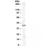 Western blot testing of human kidney lysate with CDX2 antibody at 1ug/ml. Predicted molecular weight: 33-40 kDa.