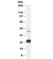 Western blot testing of human HeLa cell lysate and NIP antibody at 0.03ug/ml. Predicted molecular weight: ~36/26kDa (isoforms 1/2).