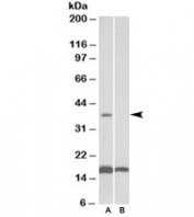 Western blot testing of human frontal cortex lysate with CD57 antibody at 0.1ug/ml with [B] and without [A] immunizing peptide. Predicted/observed molecular weight ~38kDa.