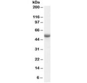 Western blot testing of human ovay lysate with TRAF2 antibody at 0.1ug/ml. Predicted molecular weight: ~55 kDa.