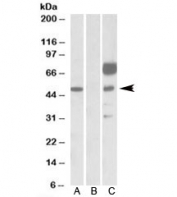 Western blot testing of HEK293 lysate overexpressing human ANGPT1-FLAG with ANGPT1 antibody [1ug/ml] in Lane A and probed with anti-FLAG [1/1000] in lane C. Mock-transfected HEK293 probed with ANGPT1 antibody [1ug/ml] in Lane B. Predicted molecular weight: ~57kDa.