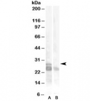 Western blot testing of muscle lysate with MYF5 antibody at 0.5ug/ml with [B] and without [A] blocking/immunizing peptide. Predicted molecular weight ~28kDa.
