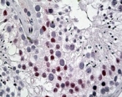 IHC testing of FFPE human human testis with DENTT antibody at 5ug/ml. HIER: steamed with pH6 citrate buffer, AP-staining.