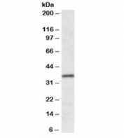 Western blot testing of human colon lysate with HOXA4 antibody at 0.1ug/ml. Predicted molecular weight: ~35kDa.