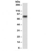 Western blot testing of bone marrow lysate with DDX41 antibody at 0.5ug/ml. Predicted molecular weight: ~70kDa, observed here at ~82kDa.