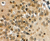 IHC testing of FFPE human hippocampus with NOTCH3 antibody at 4ug/ml. HIER: steamed with pH6 citrate buffer, HRP-staining.