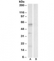 Western blot testing of human spleen lysate with LAT1 antibody at 0.3ug/ml with [B] and without [A] blocking/immunizing peptide. Predicted molecular weight ~55kDa.
