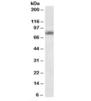 Western blot testing of Jurkat lysate with TSPYL2 antibody at 0.3ug/ml. Predicted molecular weight: ~79kDa.