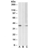 Western blot of HEK293 lysate overexpressing human MYF6-MYC with MYF6 antibody (0.5ug/ml) in Lane A and anti-MYC (1/1000) in lane C. Mock-transfected HEK293 probed with MYF6 antibody (0.5ug/ml) in Lane B. Predicted molecular weight: ~30kDa, observed here at ~37kDa.