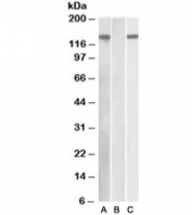 Western blot of HEK293 lysate overexpressing human NLRP2 with DYKDDDDK tag probed with NALP2 antibody [1ug/ml] in Lane A and probed with anti-DYKDDDDK tag [1/1000] in lane C. Mock-transfected HEK293 probed with NALP2 antibody [1ug/ml] in Lane B.