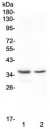 Western blot testing of 1) rat spleen and 2) rat thymus with Cd8a antibody at 0.5ug/ml. Expected molecular weight: 26-40 kDa depending on glycosylation level.
