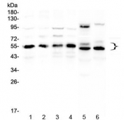 Western blot testing of human 1) HeLa, 2) COLO320, 3) A431, 4) MCF7, 5) rat heart and 6) mouse heart lysate with RXRA antibody at 0.5ug/ml. Predicted molecular weight: ~51 kDa but routinely observed at 54~60 kDa.