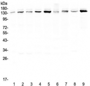 Western blot testing of human 1) HeLa, 2) 22RV1, 3) A431, 4) HepG2, 5) HepG2, 6) SGC-7901, 7) A549, 8) rat brain and 9) mouse testis lysate with USP7 antibody at 0.5ug/ml. Predicted molecular weight ~128 kDa, observed at ~135 kDa.