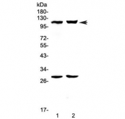 Western blot testing of 1) mouse heart and 2) rat heart lysate with P-Selectin antibody. Expected molecular weight: 91-140 kDa depending on glycosylation level.
