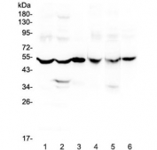 Western blot testing of rat 1) brain, 2) liver, 3) small intestine and mouse 4) brain, 5) liver and 6) small intestine lysate with GDA antibody at 0.5ug/ml. Predicted molecular weight ~51 kDa.