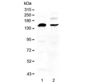 Western blot testing of human 1) U-87 MG and 2) MDA-MB-453 cell lysate with NEDD4 antibody at 0.5ug/ml. Predicted molecular weight ~149 kDa; commonly observed at 110-149 kDa with a possible ~95 kDa cleavage band.