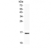 Western blot testing of human SK-OV-3 cell lysate with NPC2 antibody at 0.5ug/ml. Predicted molecular weight: ~17 kDa, can be observed as a ~21/23 kDa doublet in human samples. (Ref 1).