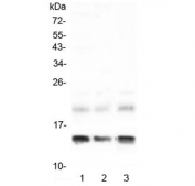 Western blot testing of 1) rat liver, 2) rat RH35 and 3) mouse liver lysate with FABP1 antibody at 0.5ug/ml. Predicted molecular weight ~14 kDa.