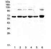 Western blot testing of human 1) COLO-320, 2) A549, 3) HepG2, 4) MDA-MB-231, 5) PANC-1 and 6) A375 lysate with p65 antibody at 0.5ug/ml. Expected molecular weight ~65 kDa.