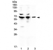 Western blot testing of 1) human Jurkat, 2) human CCRF-CEM and 3) mouse NIH3T3 cell lysate with CD5 antibody at 0.5ug/ml. Expected molecular weight: 55-67 kDa depending on glycosylation level.