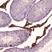 IHC testing of FFPE mouse testis tissue with Cyp17a1 antibody at 2ug/ml. HIER: boil tissue sections in pH6, 10mM citrate buffer, for 10-20 min followed by cooling at RT for 20 min.