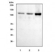 Western blot testing of human 1) HeLa, 2) COLO-320 and 3) SW620 cell lysate with Smoothelin antibody at 0.5ug/ml. Predicted molecular weight ~99 kDa but commonly observed at ~110 kDa (long form).